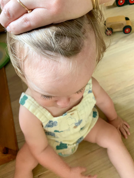 Cradle Cap oil
